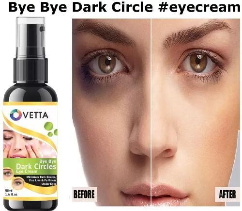Vetta eye cream bottle with 'Bye Bye Dark Circles' text, showing a before and after effect on dark circles.